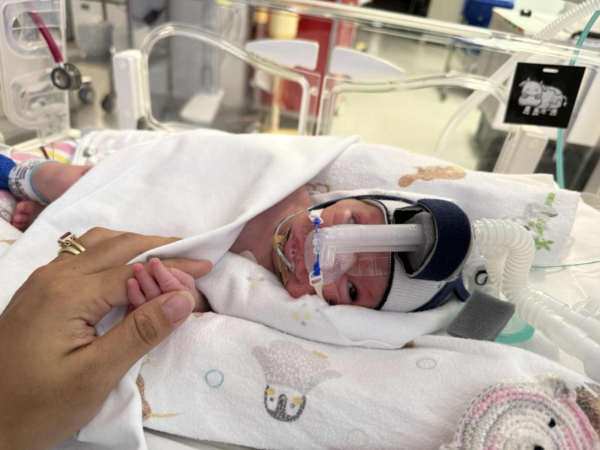World Prematurity Day: Ambre's story of courage, family and life born too soon